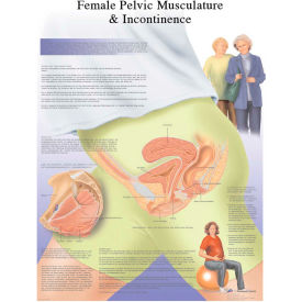 3B® Anatomical Chart - Female Urinary Incontinence Chart, Laminated