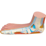 3B® Anatomical Model - Flat Foot (Pes Panus)