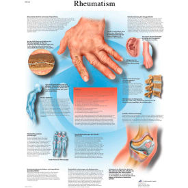 3B® Anatomical Chart - Rheumatic Diseases, Laminated