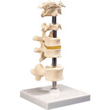 3B® Anatomical Model - 6 Mounted Vertebrae with Removable Stand