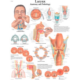 3B® Anatomical Chart - Larynx, Laminated