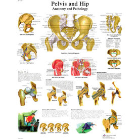 3B® Anatomical Chart - Hip & Pelvis, Laminated