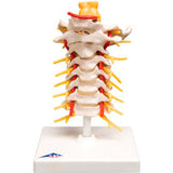 3B® Anatomical Model - Cervical Spinal Column