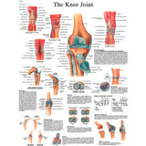 3B® Anatomical Chart - Knee Joint, Laminated