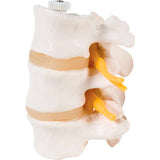 3B® Anatomical Model - 3 Lumbar Vertebrae, Flexibly Mounted